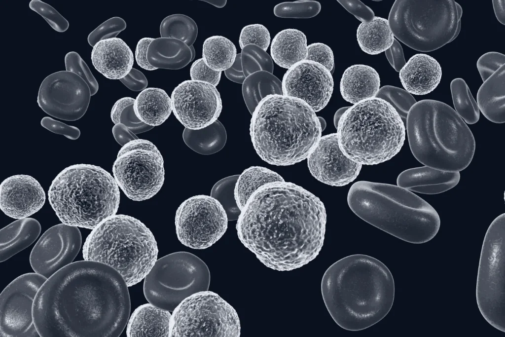 Leucemia Linfoide Aguda