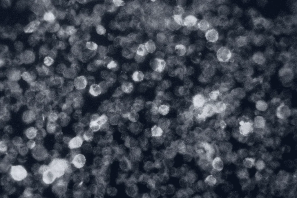 Leucemia Mieloide Crônica