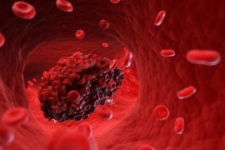 Distúrbio da coagulação do sangue